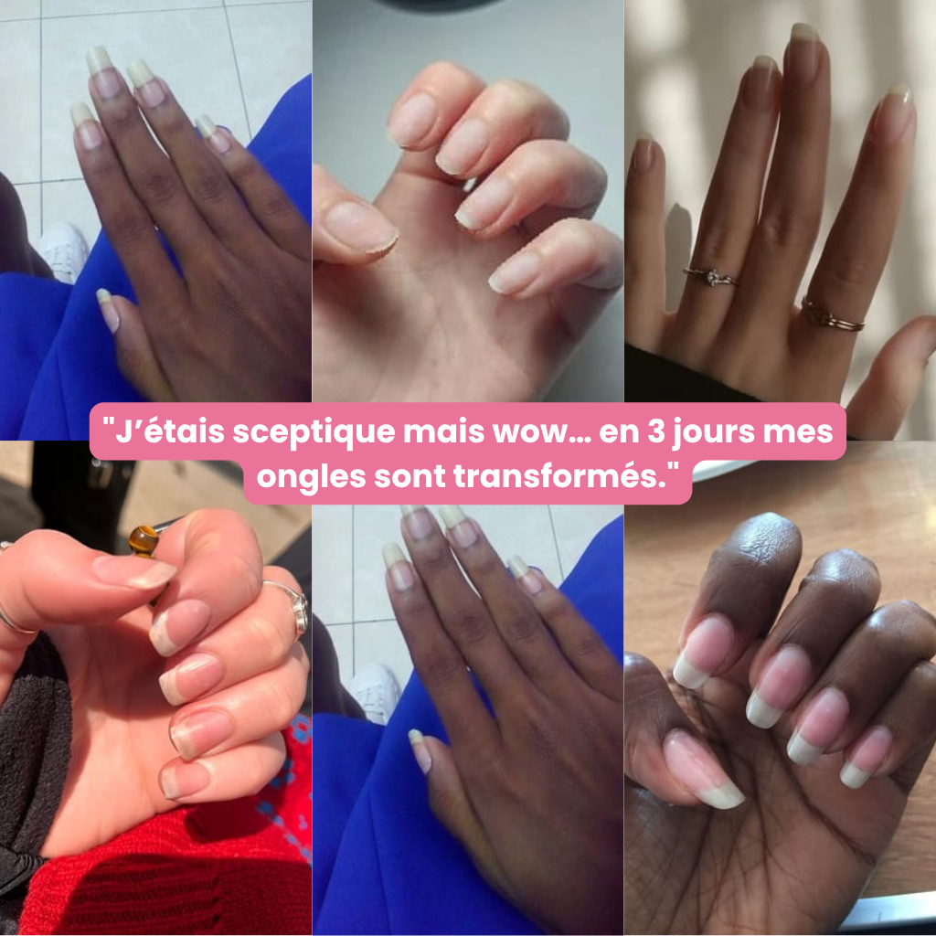 Stem Nail Pen